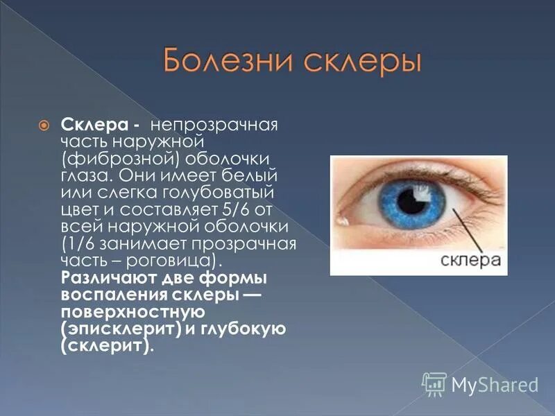 Части сосудистой оболочки глазного яблока. Наружная оболочка глазного яблока. Лимб роговицы строение. Переходит в непрозрачную внешнюю оболочку глаза склеру. Белочная оболочка склера строение.