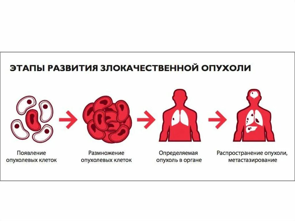 Причины возникновения опухолей. Причины возникновения опухолей у человека. Онкология причины возникновения опухолей. Причины рака у людей