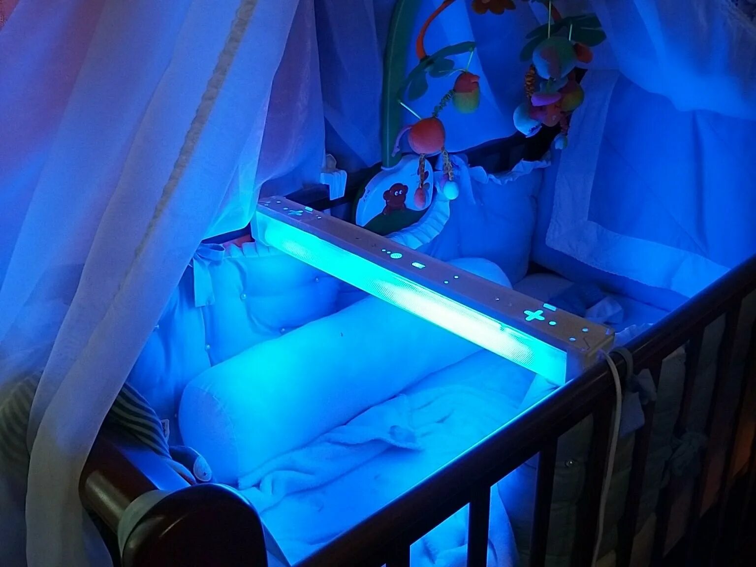 Ставили под лампой. Желтушка у новорожденных лампа ультрафиолетовая. Фототерапия для новорожденных при желтухе. Уф лампа от желтушки для новорожденного. Фотолампа от желтухи для новорожденных philips.