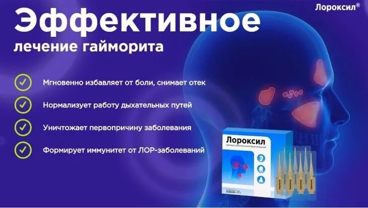 Таблетки отигайморита. Таблетки для очищения пазух носа. Противовоспалительные препараты при гайморите у взрослых. Лекарство от гайморита таблетки синупрет. Противовоспалительные препараты при гайморите у взрослых.