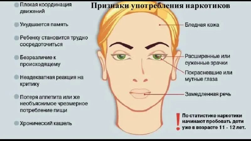 Глаза при употреблении. Расширенные зрачки наркомана. Зрачки наркомана употребляющего. Зрачки при употреблении наркотиков. Глаза при наркотическом опьянении.