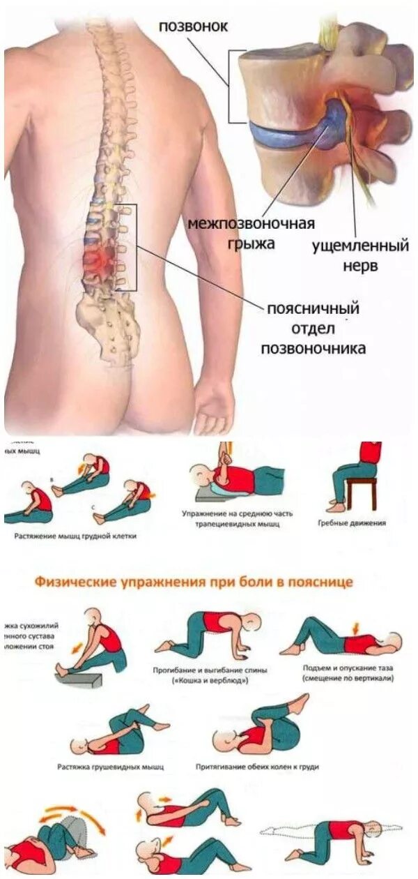 Лечение поясницы в домашних условиях. Упражнения при грыже позвоночника. Грыжа в поясничном отделе упражнения. Гимнастика для межпозвоночной грыжи поясничного отдела. Поясничная грыжа упражнения.