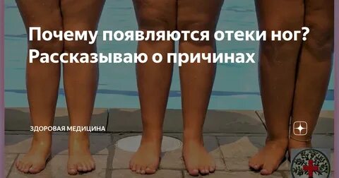 Отек левой лодыжки причины
