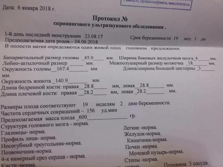 Скрининг при беременности на какой неделе. 32 Неделя беременности скрининг УЗИ. УЗИ 20 недель беременности норма. 2 Скрининг нормы показателей УЗИ 20 недель. УЗИ скрининг плода в 20 недель беременности.