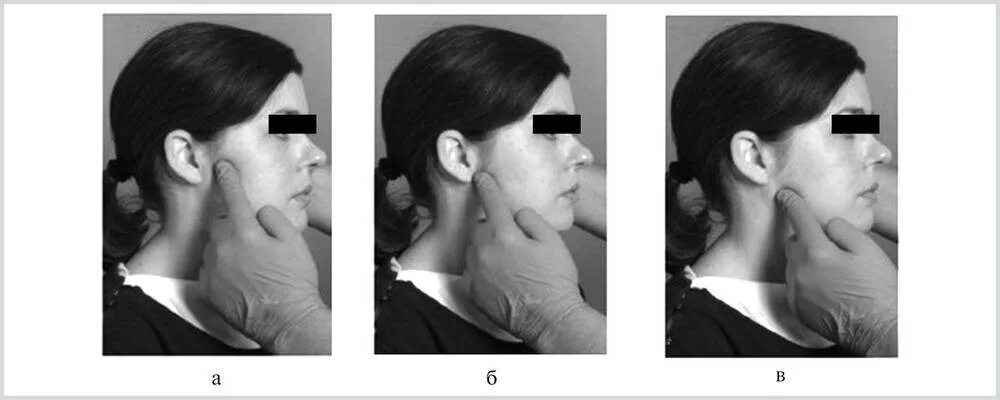 Больно открывать рот. Дисфункция ВНЧС асимметрия. Пальпация жевательных мышц и ВНЧС. Методика пальпации ВНЧС.