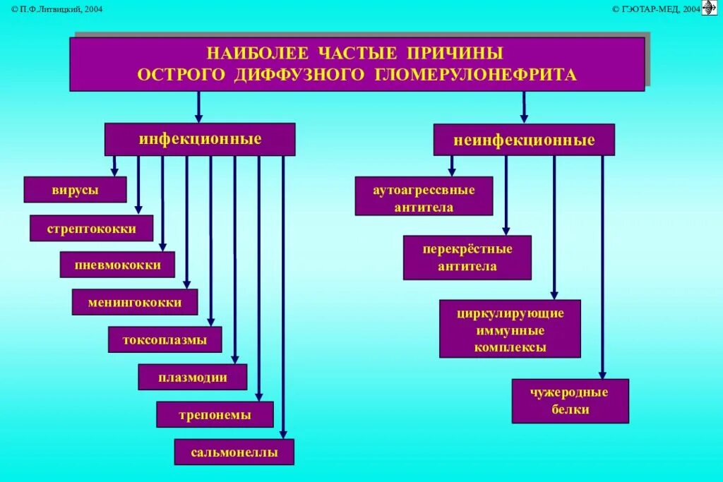 Острым гломерулонефритом является