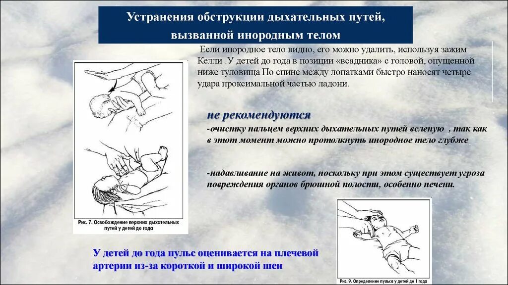 Обструкция дыхательных путей инородным телом первая помощь. Инородные тела верхних дыхательных путей. Инородное тело в дыхательных путях у ребенка. Освобождение дыхательных путей от инородных тел. Профилактика попадания инородных тел в дыхательные пути.