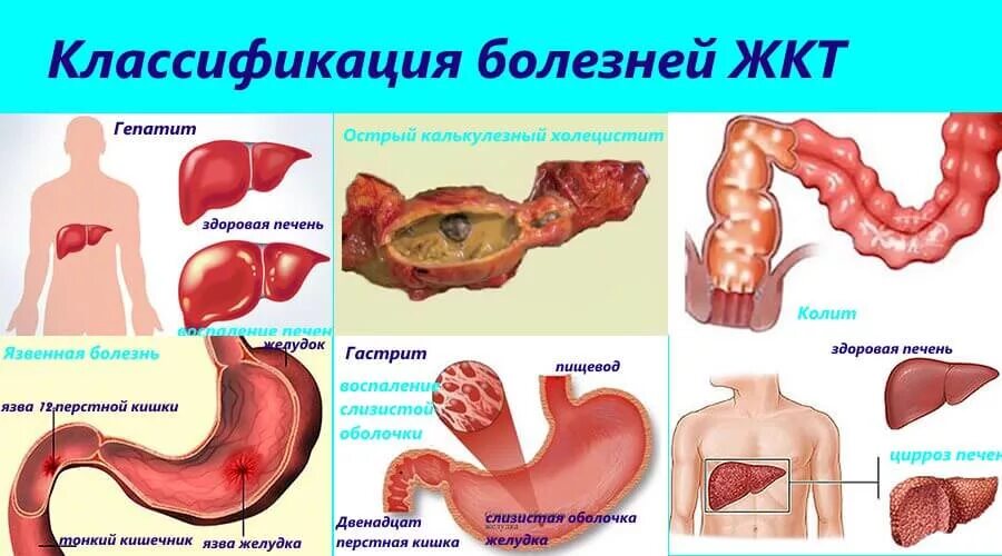 Вызывает заболевание кишечника. Заболевания пищеварительного тракта. Болезни системы пищеварения. Заболевания пищеварительной системы желудка.