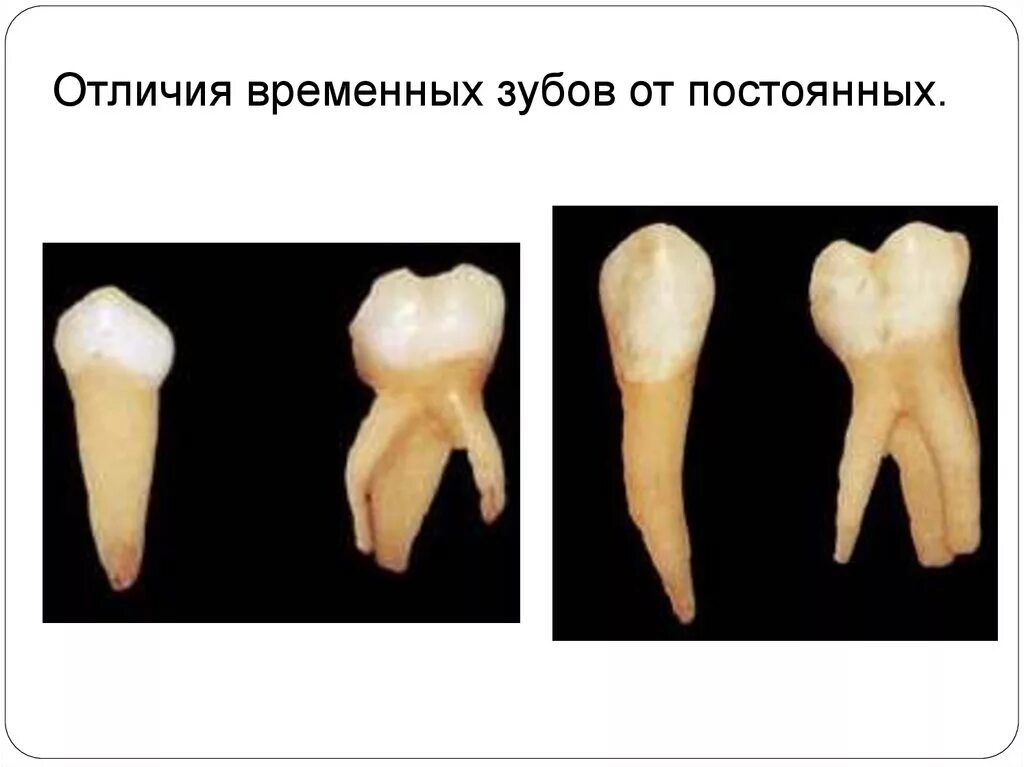 Почему зубы отличаются