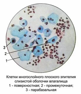 Промежуточные клетки плоского эпителия что это