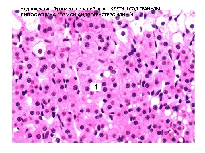 Сетчатая зона надпочечников гистология. Феохромоцитома надпочечника гистология. Кровоизлияние в надпочечник микропрепарат. Липофусцин гистология.