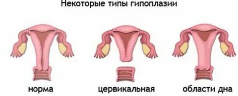 Матки причины