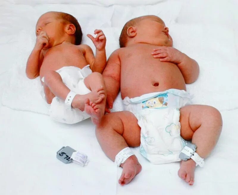 Плод 31-32 недели беременности. Купание новорожденного ребенка. Новорожденный ребенок в больнице. Самый милый ребенок. После того как малыш в.