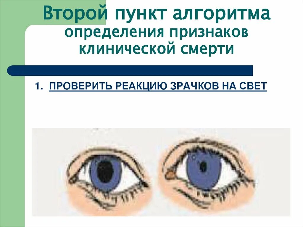 Оценка реакции зрачков на свет. Выявление реакции зрачка на свет. Клиническая смерть зрачки.