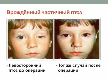 Диагноз век