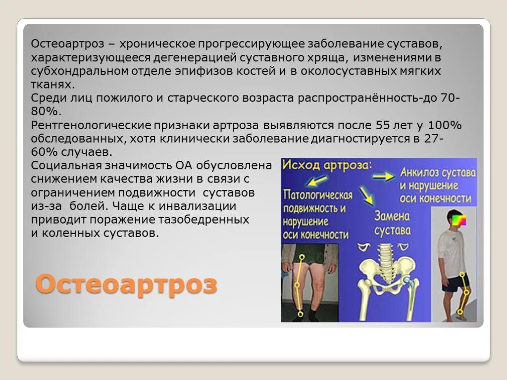 Стадии развития суставов. Поражение коленного сустава. Суставные заболевания. Суставные поражения при ревматоидном артрите. Болезни коленного сустава список.