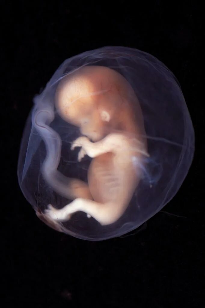 Эмбрион на 9 неделе беременности фото. Эмбрион на 10 неделе беременности. Эмбрион на 9-10 неделе беременности. Как выглядит ребенок на 8 неделе