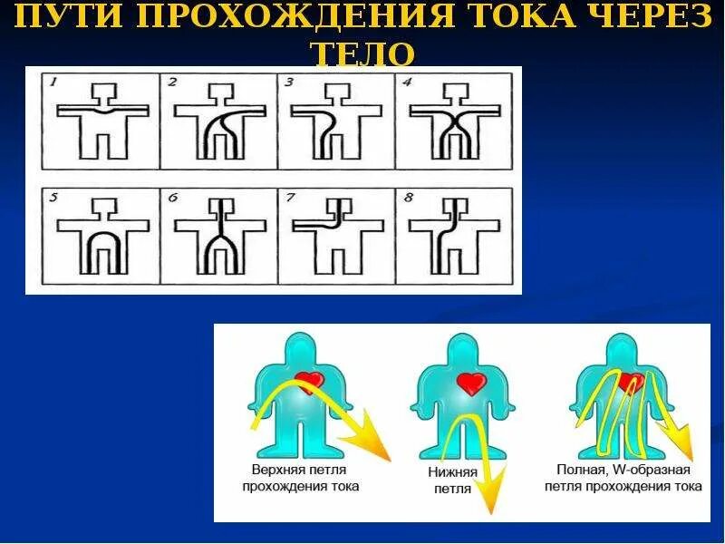 Пути поражения током. Путь тока через тело человека. Пути прохождения электрического тока. Пути прохождения электрического тока через тело человека. Схемы прохождения электрического тока через тело человека.