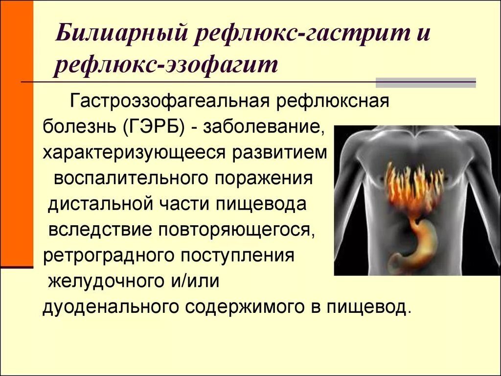Гастроэзофагеальной рефлюксной болезнь симптомы болезни. Грыжа пищеводного отверстия диафрагмы. Симптомы гастрита желудка. Схема терапии хронического панкреатита. Гастрит, язвенная болезнь, панкреатит.
