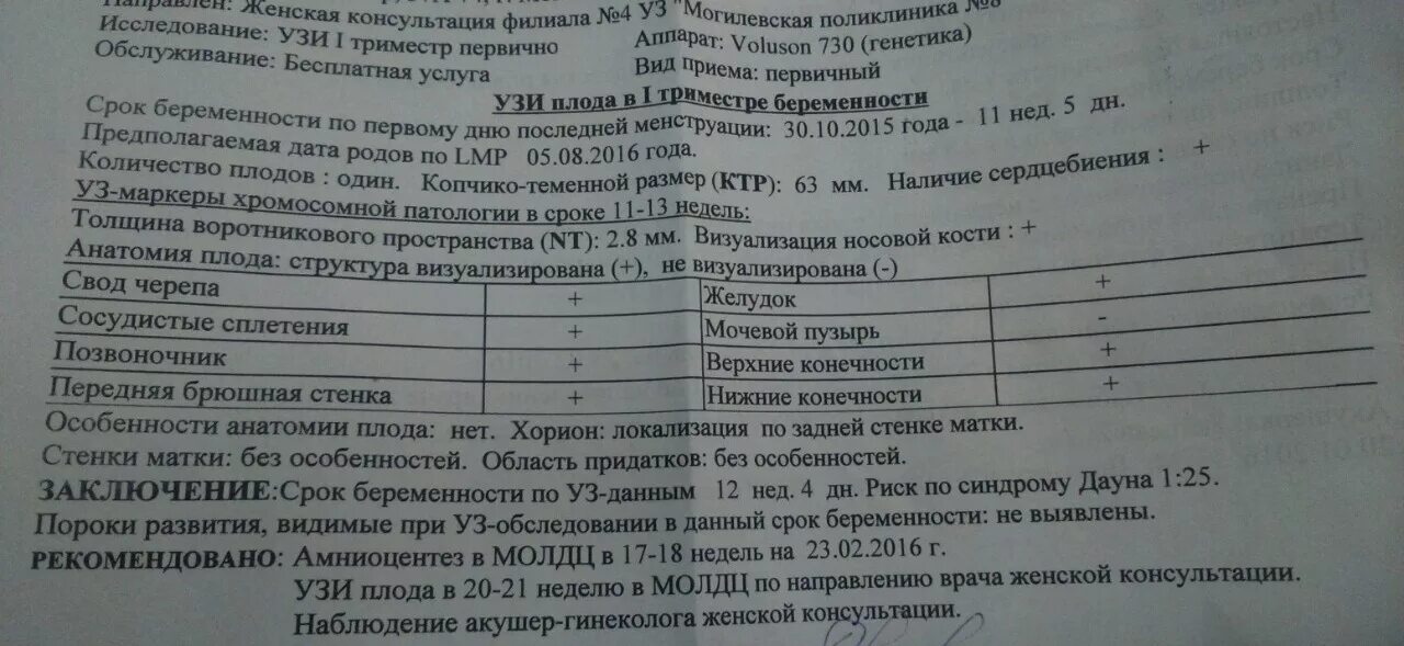 Синдром дауна 2 триместра. Узи плода на 12 неделе беременности с синдромом дауна. синдром дауна на узи 12 недель. синдром дауна на узи 2 триместр.