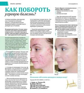 Демодекоз эффективное лечение