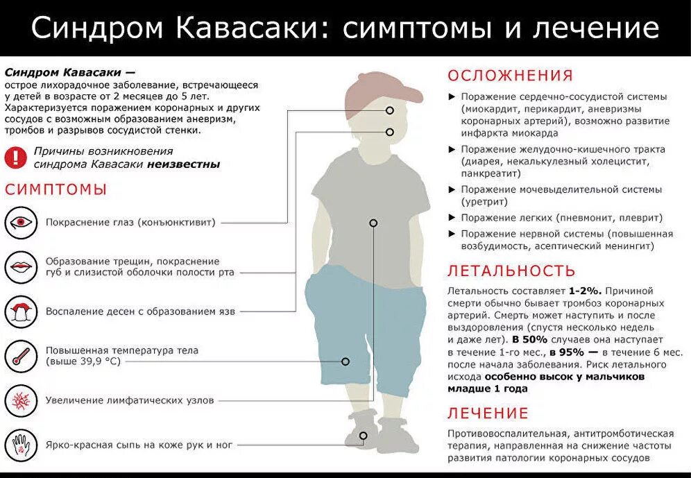 Есть ли ковид у детей. Болезнь кавасаки диагностические критерии у детей. синдром кавасаки симптомы.