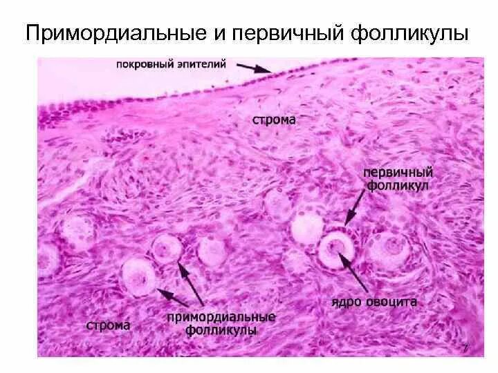 Строение фолликула гистология. Примордиальный фолликул яичника гистология. строение фолликула яичника гистология. примордиальный фолликул гистология препарат. вторичный фолликул гистология.