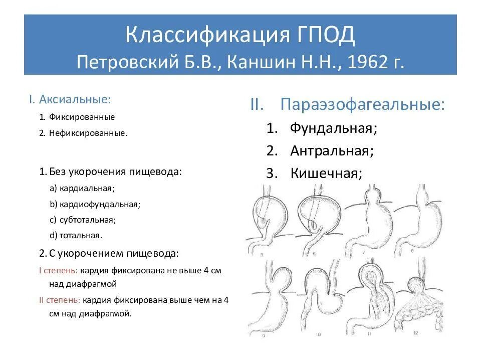 Кардиальная грыжа под. Грыжи пищеводного отверстия диафрагмы классификация. Степени грыжи пищеводного отверстия диафрагмы классификация. Грыжа пищеводного отдела диафрагмы классификация. Классификация грыжи пищеводного отверстия диафрагмы рентген степени.