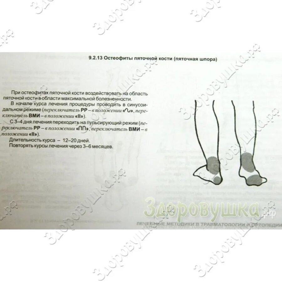 Магнитер АМТ-02. Магнитер АМТ-02 инструкция. Магнитотерапия аппараты АМТ 02 инструкция. Аппарат Магнитер АМТ-02 для низкочастотной магнитотерапии. Алмаг при шпоре