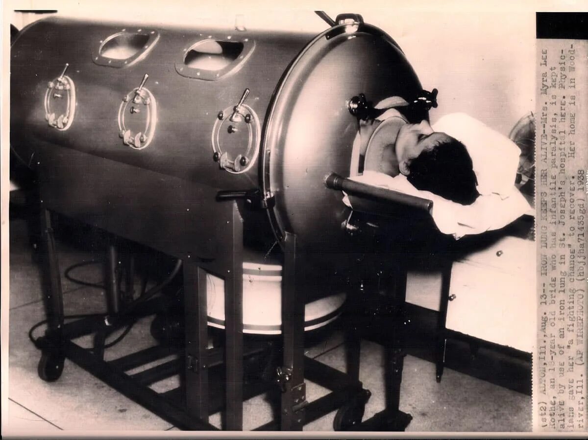 Iron lung Iron lung. Железное легкое аппарат полиомиелит. Iron lung 2022. Железные легкие аппарат. 70 лет в железном легком