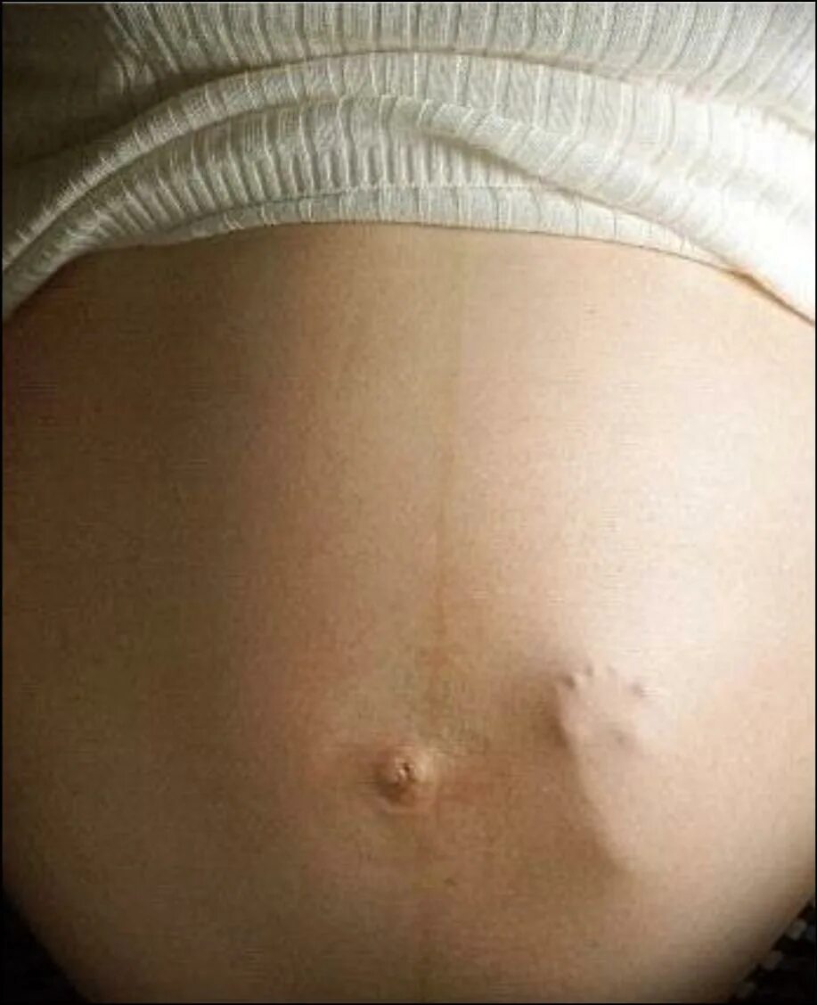Беременность сильно шевелиться. Ребенок толкается в животе. Шевеления ребёнка в животе. Ребёнок пинается в жиаоте.