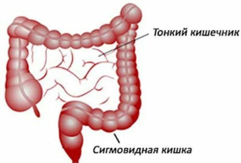 Сигма кишечника