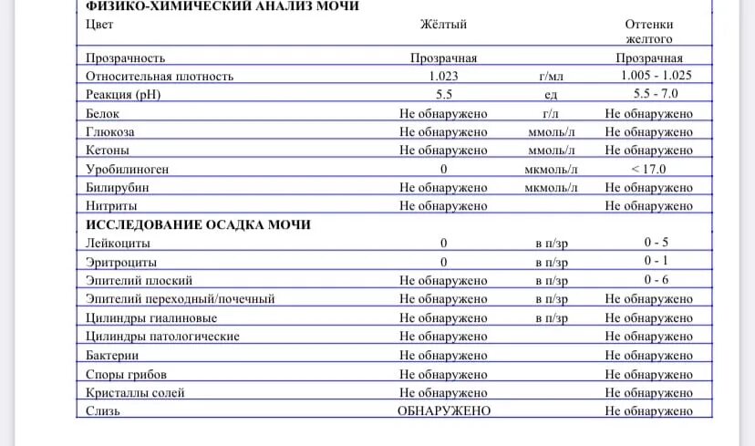 Слизь в анализе мочи. Автоматизированные исследование мочи слизь. Анализ мочи обнаружена слизь. Норма слизи в моче у женщин. Моче слизь эритроциты