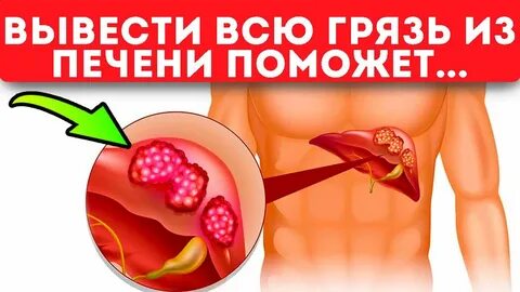 Матрица печень