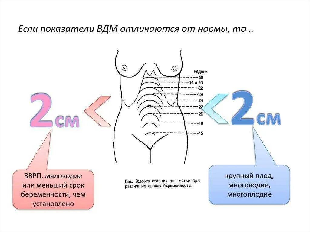 Дно матки после родов. Высота дна матки на 24 неделе беременности. Норма высоты дна матки по неделям беременности. Высота стояния дна матки по неделям беременности. Размер стояния дна матки по неделям.