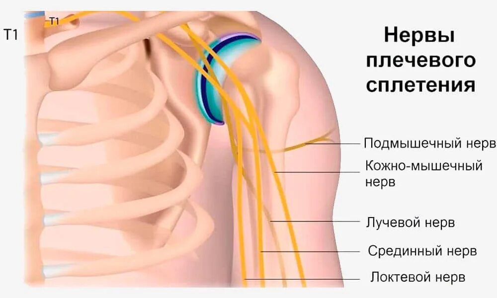Защемление локтевого сустава. Анатомия локтевого нерва на плече. локтевой сустав ход нервов. локтевой нерв ход нерва.