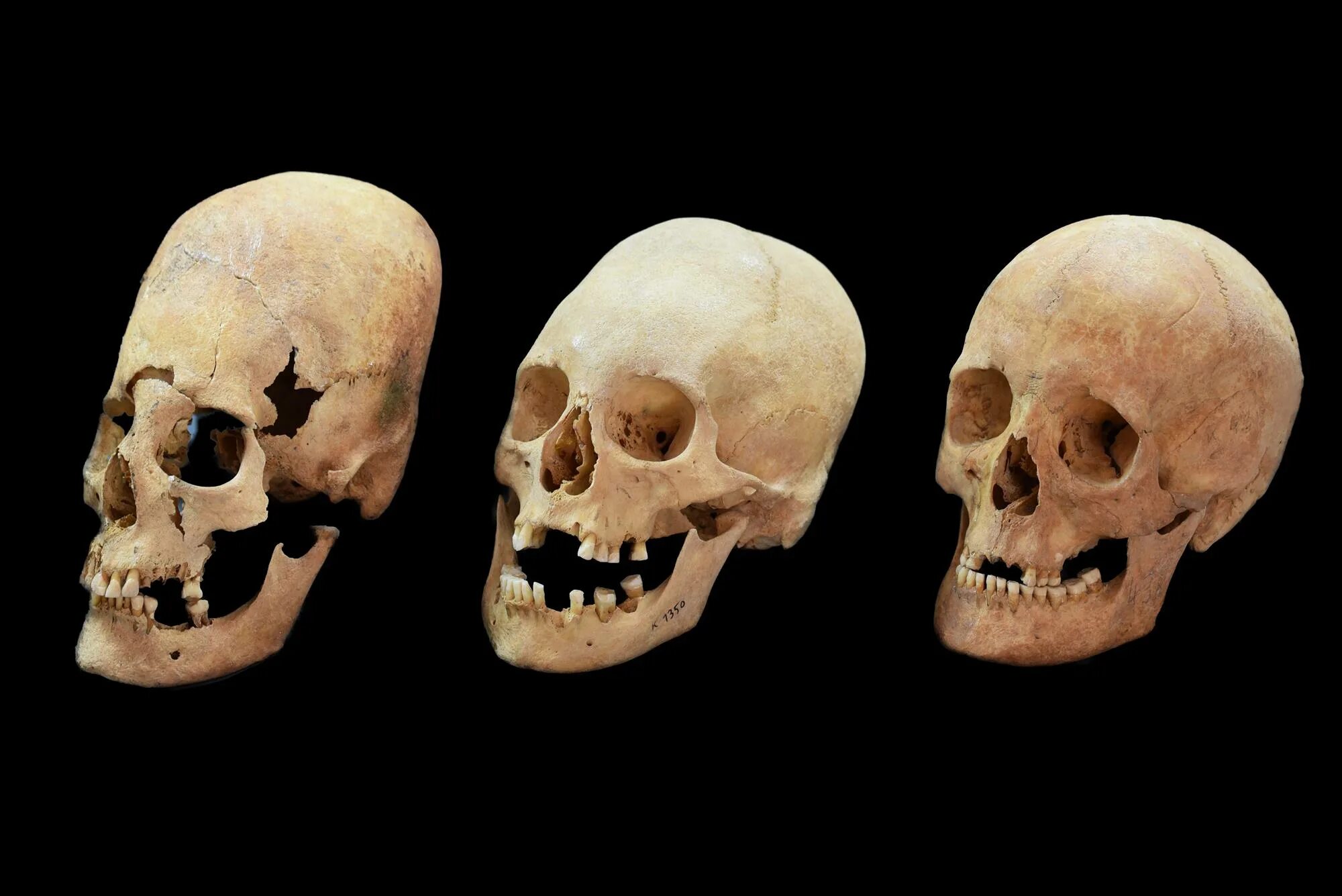 Варианты формы черепа. Черепа Паракаса Elongated Skulls. Деформация черепа Гунны.