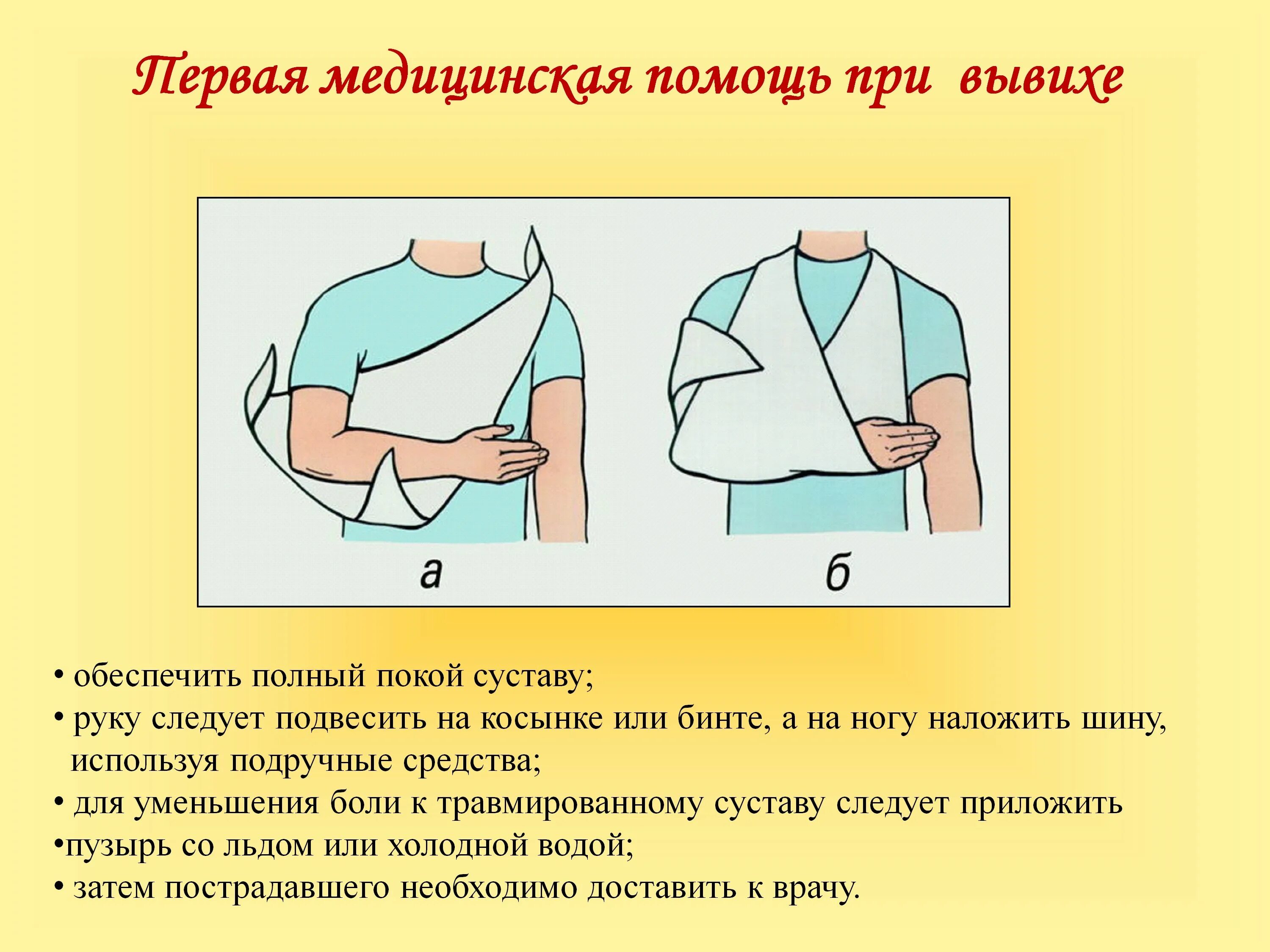 Алгоритм оказания первой медицинской помощи при вывихах. Алгоритм оказания первой помощи пострадавшему при вывихах. Меры оказания первой помощи при вывихе. Алгоритм действий по оказанию первой медицинской помощи при вывихах.