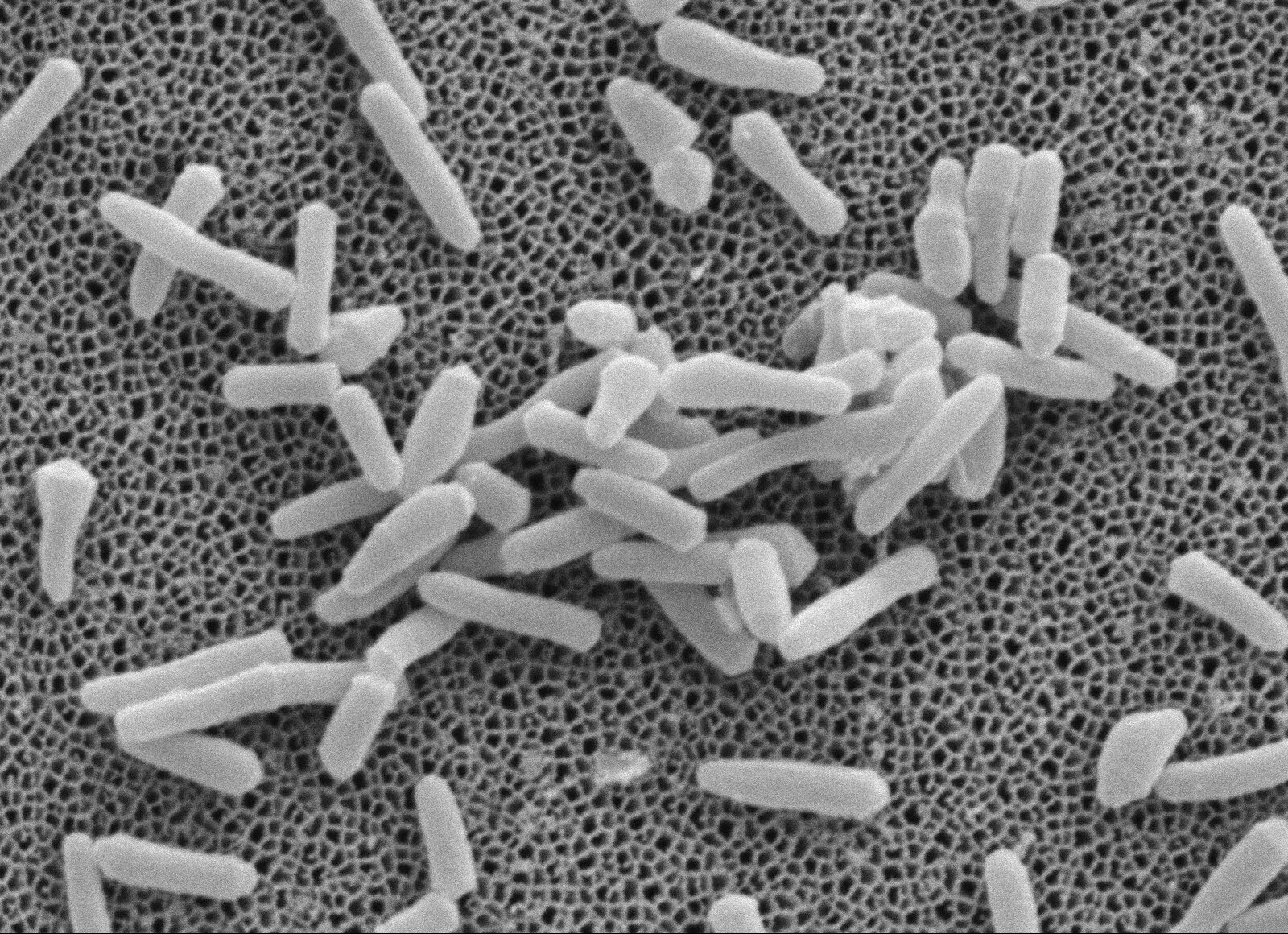 Бактерии в слюне. Палочка Коха Mycobacterium tuberculosis. Микобактерии туберкулеза электронная микроскопия. Микобактерии туберкулеза под микроскопом. Туберкулезная палочка микроскопия.