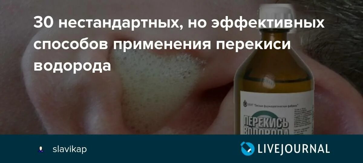 Швы можно обрабатывать перекисью водорода. Тонзиллит и перекись водорода. Ожог перекесесью водорода. Аллергия на перекись водорода. Реакция кожи на перекись водорода.