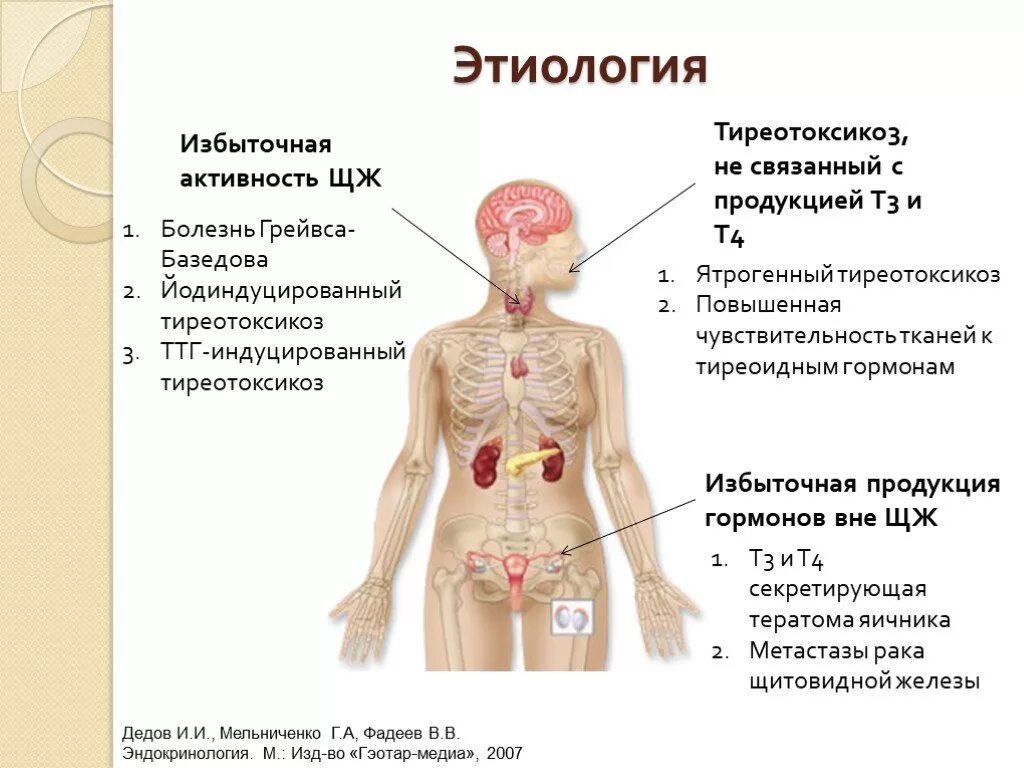 Болезнь и т п. Тиреотоксикоз этиология. Этиология, клиника, патогенез тиреотоксикоза.. Базедова болезнь этиология и патогенез. Гипертиреоз этиология.