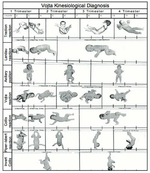 Таблица войта по развитию. Таблица войта по развитию. Таблица по войта. Таблица навыков войта. Таблица развития ребенка по месяцам до года войта.