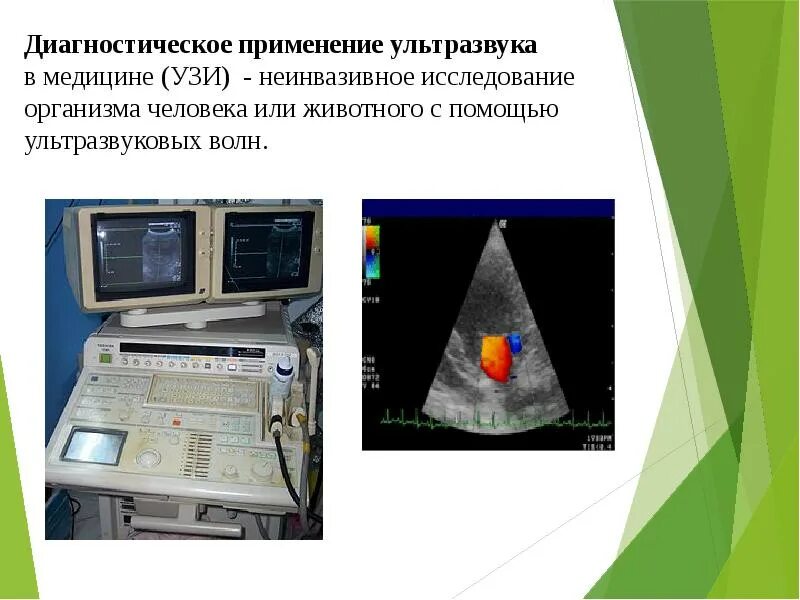 Ультразвук и инфразвук в природе техники. Примеры ультразвука. Ультразвук в природе и технике. Ультразвук и инфразвук. Ультразвук и инфразвук в технике.