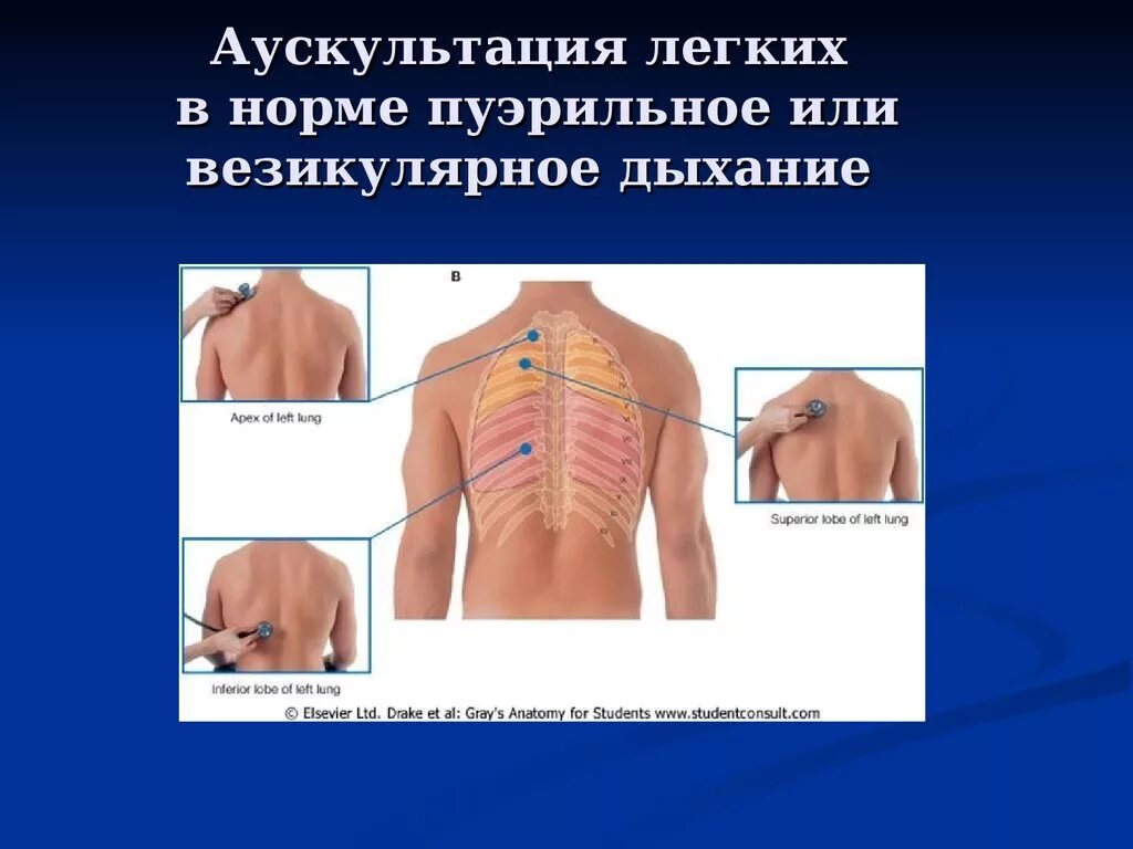 Аускультация алгоритм. Точки аускультации легких у детей. Точки аускультации легких спереди.