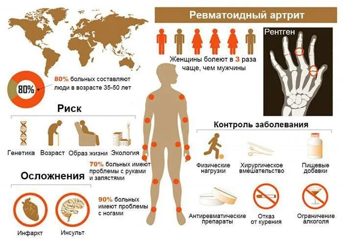 Артрит причины и лечение. Предрасполагающие факторы ревматоидного артрита. ревматоидный артрит клинические проявления. ревматоидный артрит стадии развития. клинические проявления ревматоидного артрита симптомы.