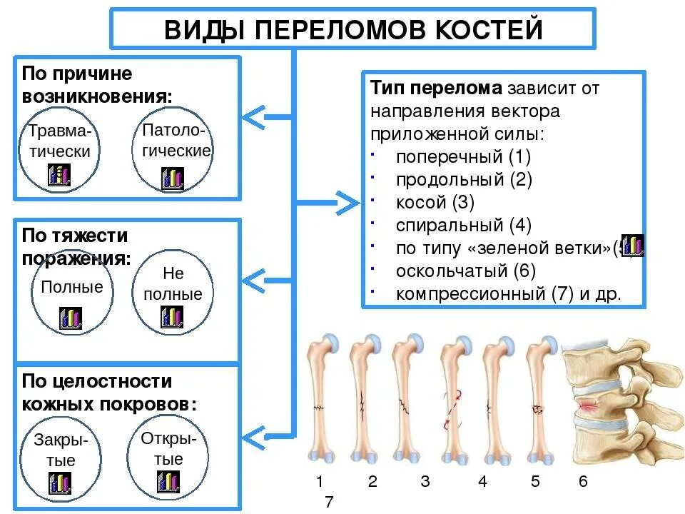 Перелом кости может быть каким. Классификация переломов костей конечностей. Классификация переломов плоских костей. Классификация переломов костей по степени тяжести.