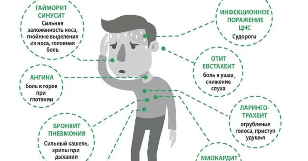 Осложненный грипп. Осложнения ОРЗ У детей. Осложнения ОРВИ У детей. Острые инфекции верхних дыхательных путей ОРЗ. Осложнения при вирусных инфекциях.