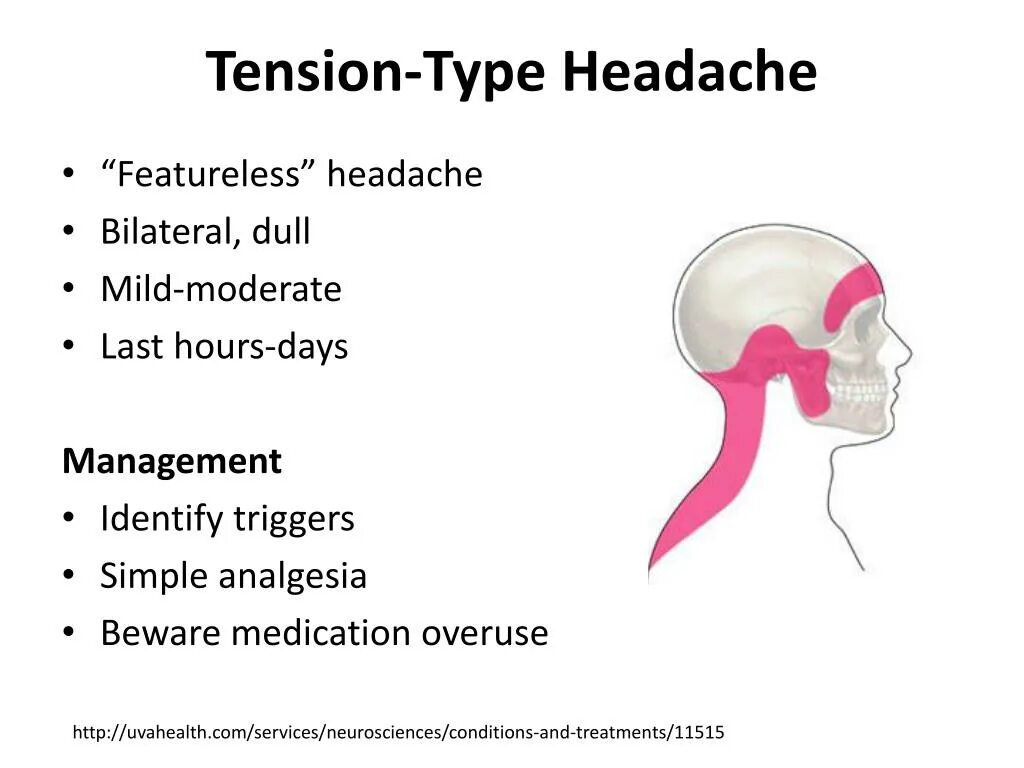 Tension headache. Tension Type headache. Tension headache Pathophysiology. Types of Hypertension.