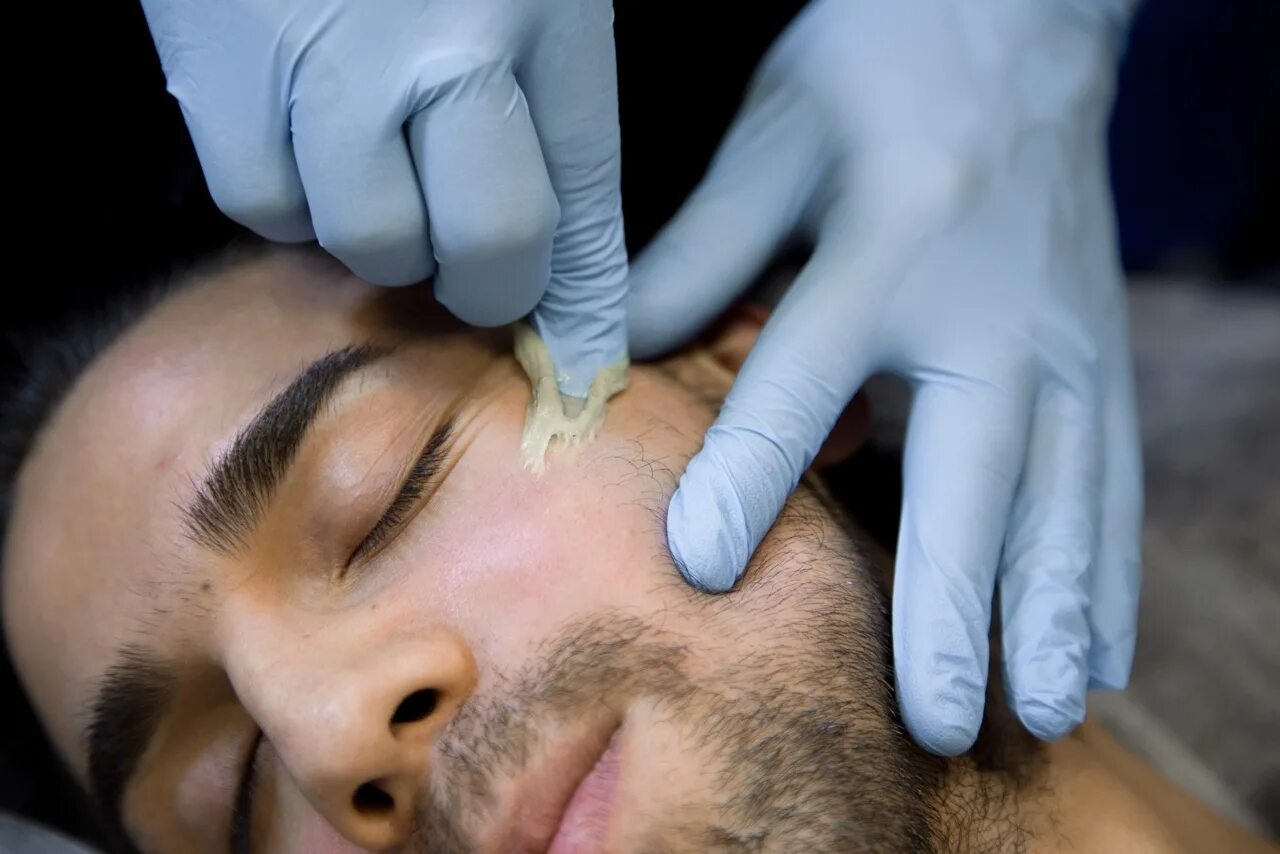 Deka moveo лазерная эпиляция. элос эпиляция глубокое бикини. депиляция воском подмышки. мужская электроэпиляция. лазерная эпиляция бороды.