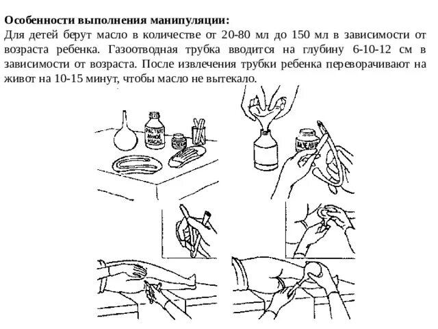 Введение очистительной клизмы. Постановка клизм Введение газоотводной трубки. Глубина введения газоотводной трубки. Газоотводная трубка вводится на глубину взрослому. Глубина введения газоотводной трубки … (См).